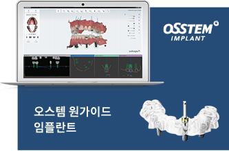 오스템 원가이드 임플란트